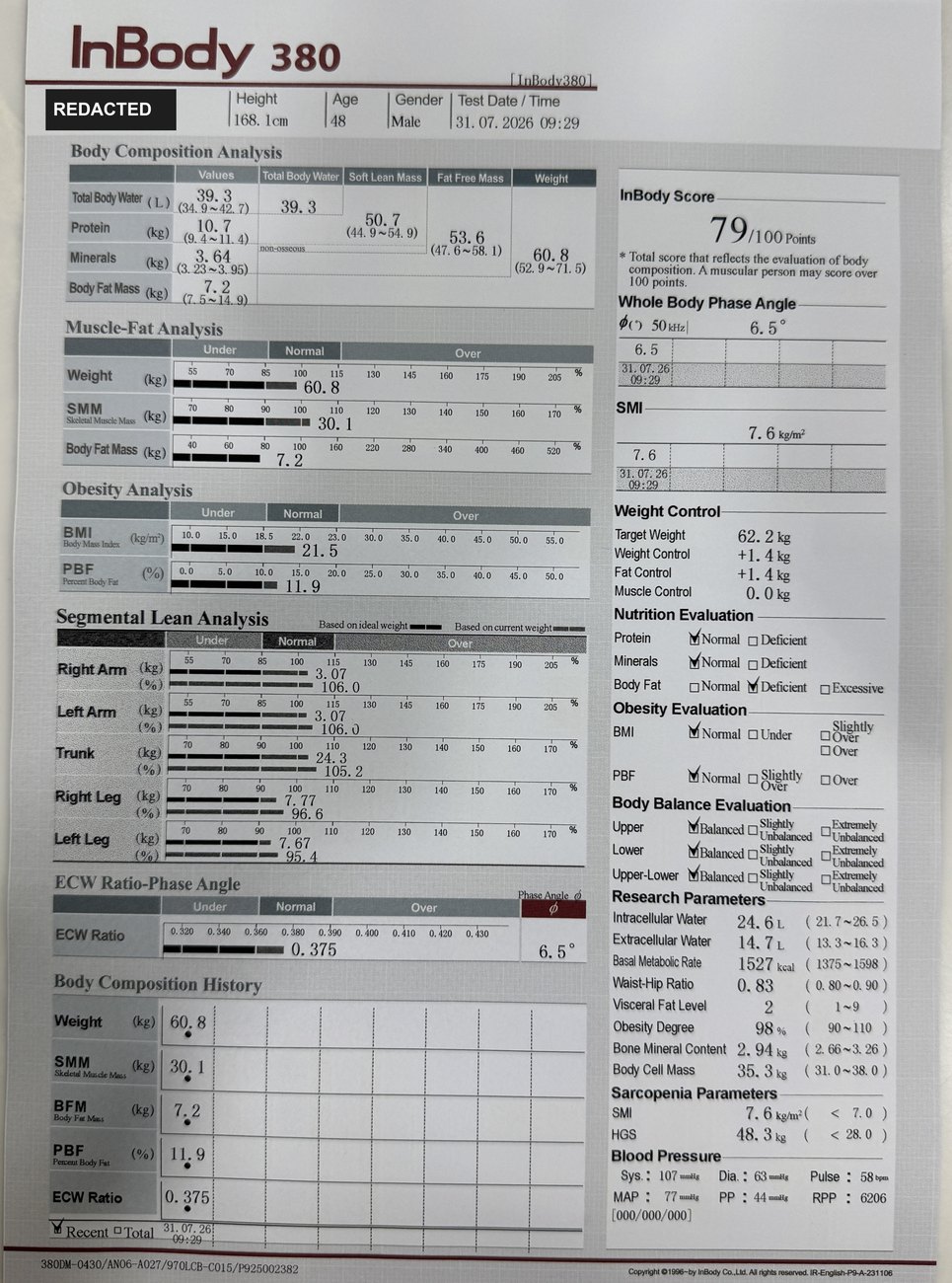 The printed body composition result sheet from the 31 July 2026 scan